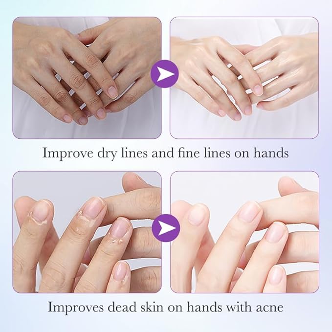 5 Pairs Hands Moisturizing Gloves, Lavender Essence Hand Skin Repair Renew Mask Infused Collagen, Vitamins + Natural Plant Extracts for Dry, Aging, Cracked Hands