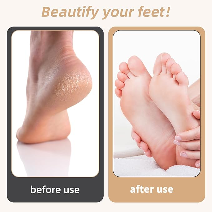 Foot Callus Remover, Foot File Callus Remover for Feet, Double Sided Foot Scrubber with Soft Silicone Brush, Pedicure Tools for Feet Care Dead Skin Calluses (Yellow)