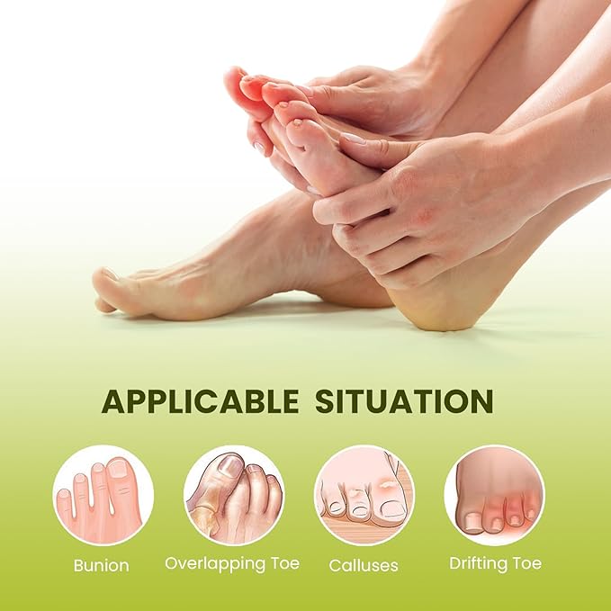 Bukihome Toe Separator for Overlapping Toes - 6 Pack Toe Spacers for Bunions with Lavender Extract - Toe Corrector for Hammer Toes, Realign Crooked Toes (Multi-Size, Lavender)