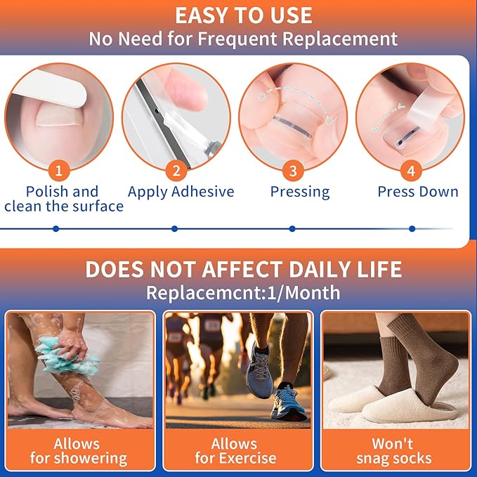 5 Sizes, 10 Pcs - Ingrown Toenail Treatment Kit, Titanium Alloy Ingrown Toenail Removal Kit, Nails Corrector Tool & Remover Strips - Ingrown Toe Nail Quick Relief(0.51/0.59/0.67/0.7/0.74 inches)