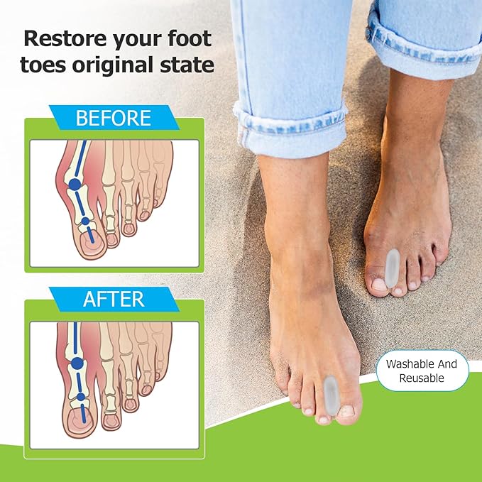Gel Toe Spacers - for Straightening Overlapping Toes - Ideal for Bunions, Corns, Blisters & Rubbing - Comfortable Toe Separators for Men and Women - 12 Pack Clear