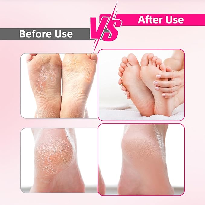 Electric Foot File Callus Remover - 3 Speeds & 4 Nano Glass Heads for Smooth Feet - Professional Pedicure Tool for Dead Skin, Hard & Cracked Heels - Rechargeable & Portable