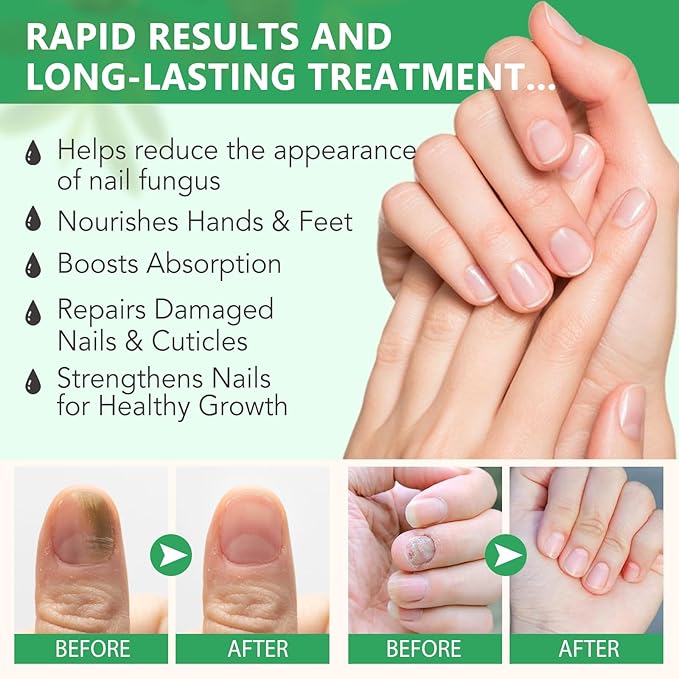 Ginger Nail Growth Strengthener Serum – Ginger-Infused Nail Repair Oil for Care, Natural Nail and Strengthener Solution