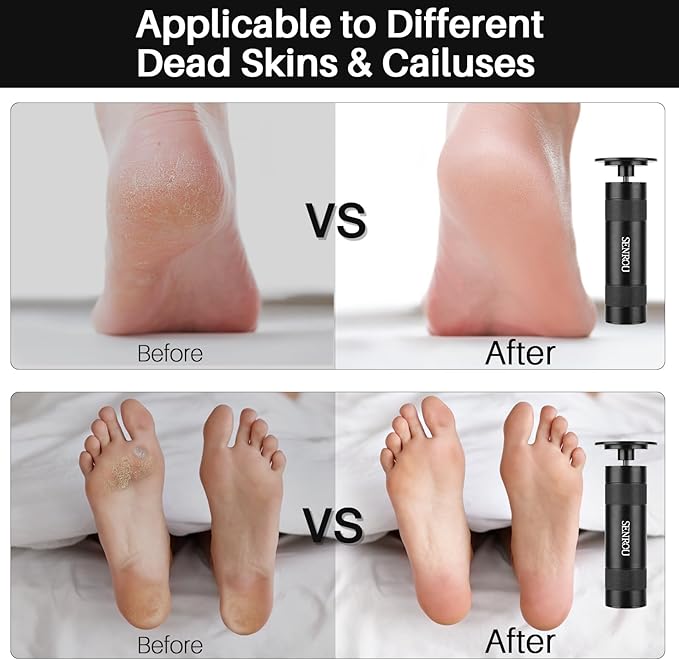 Electric Foot Callus Remover, 2-in-1 Electric Foot Filer/Nail Filer, Callus Remover for Feet with 60Pcs+12Pcs Sandpaper Discs,Holiday Gift Foot Repair Tool, Black