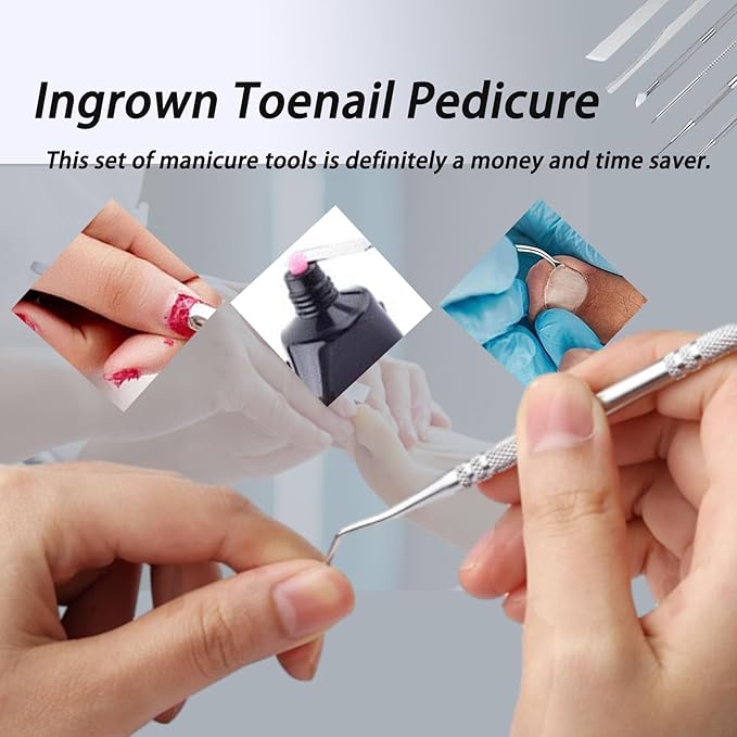 6 PCS Ingrown Toenail Treatment,Ingrown Toenail Removal Kit Under Nail Cleaner Tool Nail Cleaner Tool Toenail Kit Manicure Treatment Pedicure Tools For Feet Under Nail Cleaner Correction Polish Pain