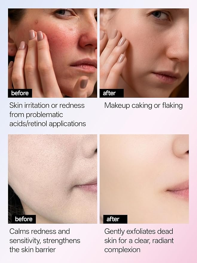 WNP 6D Bionic Collagen Bio‑Gel Mask Hydrating Overnight Real Deep with 5.1% Collagen, Niacinamide, Hyaluronic Acid, Firming, Anti‑Aging, Brightening for sensitive skin 28g x 4