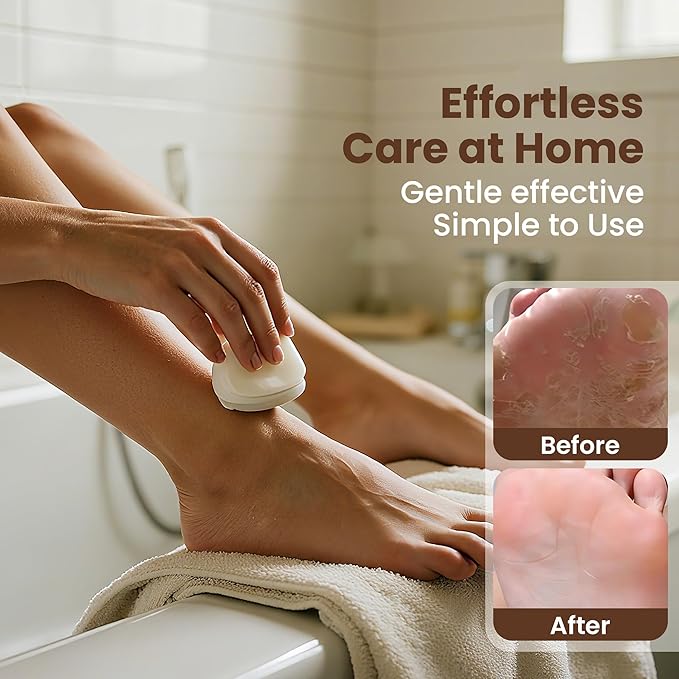 Foot File Foot Callus Remover, Foot Callus Remover, Durable Foot Scrubber, Pedicure Tools for Feet, Callus Remover for Feet, Foot File Callus Remover with Double Head Nail Files Home Manicure Tools