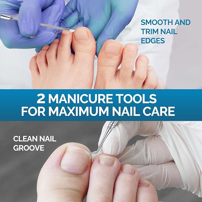 Ingrown Toenail Treatment, 50Pcs Ingrown Toenail Removal Kit with File and Lifter, Professional and Fast Acting