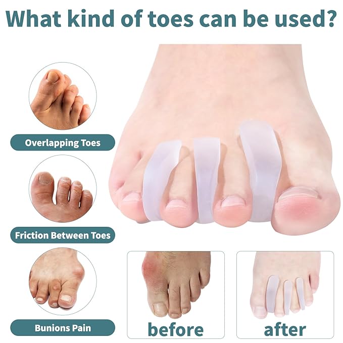 2 Pairs Silicone Toe Separators Toe Spacers for Women Men,Breathable and Soft Options for Pain from Bunions,Plantar Fasciitis, Foot Alignment(Transparent)