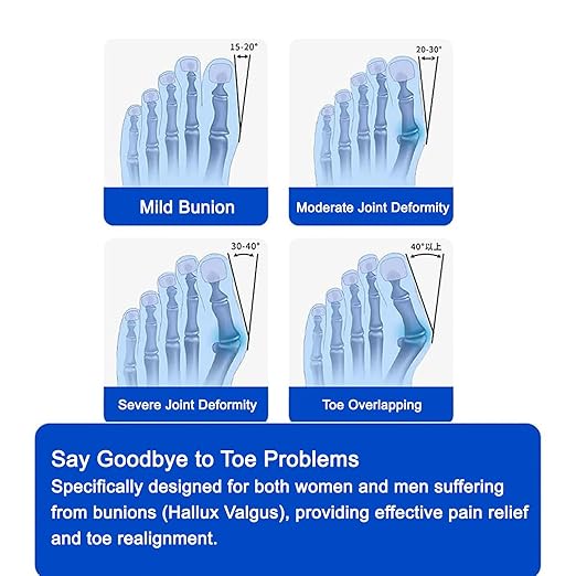 Upgraded Bunion Corrector for Women & Men, Orthopedic Bunions Correction with Non Slip Big Toe Separators, Adjustable Bunion Splint Suitable for Left/Right Foot Bunion Relief