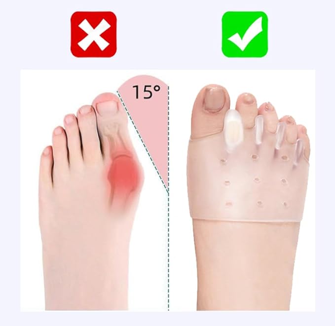 Toe separators for Women & Men， ball of foot bunion corrector toe spacers ，toe protectors women，4-Pairs bunion pads,2025 New