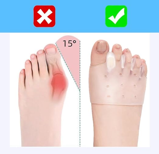 toe separators for Women & Men， ball of foot bunion corrector toe spacers ，toe protectors women，4-Pairs bunion pads,2025 New (4)