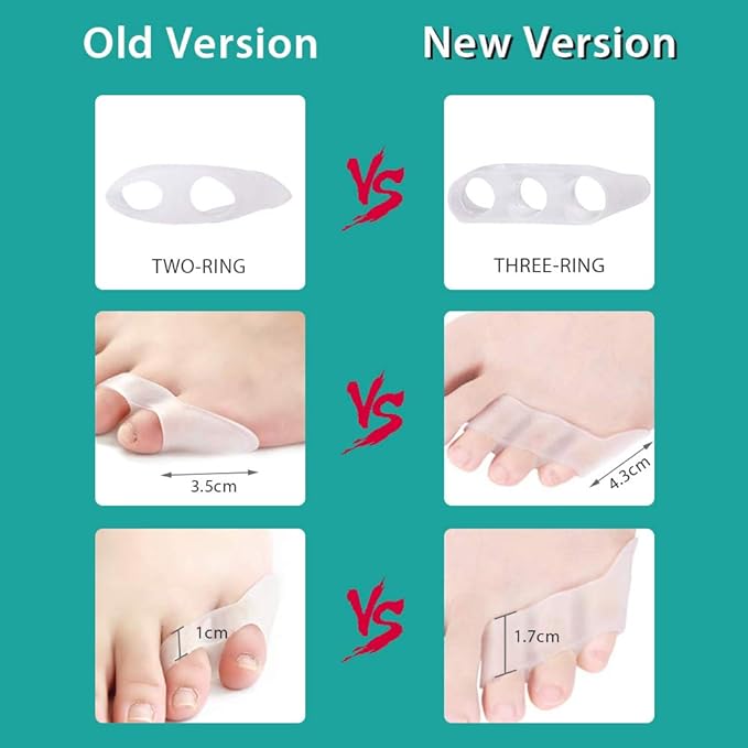 Toe Separators, 2 Pairs Toe Separator Toe Separator Feet Gel Protect Toes Separator Fingers Foot Silicone Protective Cover Protector toe separators for overlapping toes to Their Original Shape