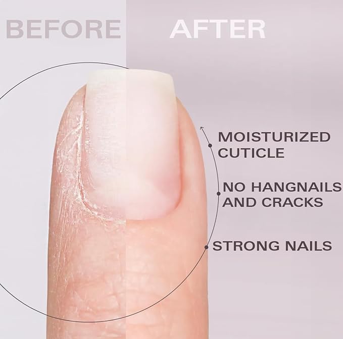 Nail Oil Cuticle Pen - Watermelon - Nail Strengthener & Growth Serum with Vitamin A, D, E, B5, Grapeseed & Natural Oils - Repair for Brittle, Peeling, Thin Nails - Twist Brush Pen