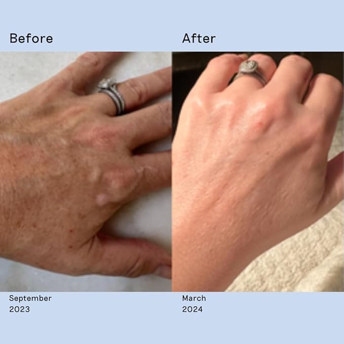 Anti-Aging Skincare Set: Habelo Activating Hand Serum + Limited Edition Treatment-Boosting Gloves | High-Performance Hydrating Hand Mask for Skin Repair and Younger-Looking Hands (Chocolate/Lavender)