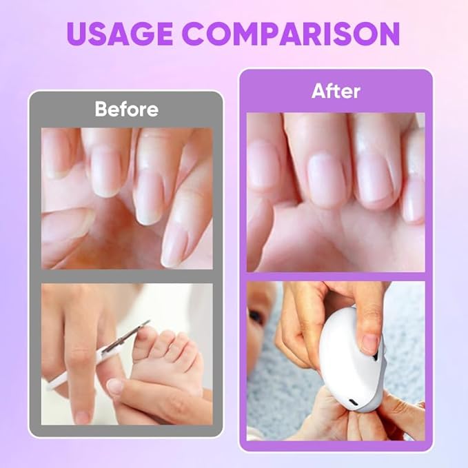 Electric Nail Clippers with Light, Baby Nail Ttrimmer Electric Automatic Finger Toe Clippers Fingernail Grinder Nail Filer Electric for Senior Adults Dual-Speed Child-Lock (Pink)