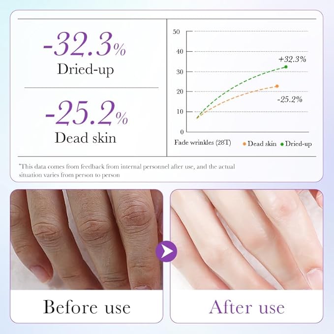 5 Pairs Hands Moisturizing Gloves, Lavender Essence Hand Skin Repair Renew Mask Infused Collagen, Vitamins + Natural Plant Extracts for Dry, Aging, Cracked Hands
