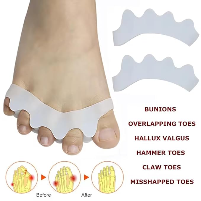 2 Pcs Toe Separators for Women & Men - Silicone Children Newborn Adult Toe Spacers for Overlapping Toes, Bunions, Hammer Toe, Toe Straightener for Foot Pain Relief ([5-11 years old] White)