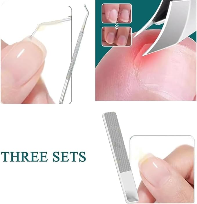 Eagle Beak Beveled Nail Clippers, 3Pcs Wide Jaw Opening Anti-Splash Slanted Nail Clipper, Long Handle Wide Jaw Opening Anti-Splash Slanted Edge Nail Clipper for Thick Nails,Seniors&Ingrown Care(Green)