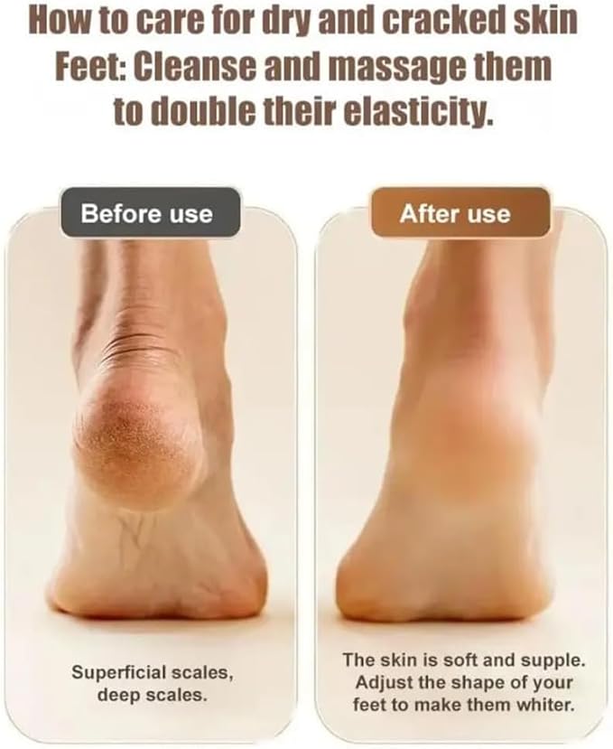 2025 New Electric Callus Remover for Feet, Portable Rechargeable Foot Repair and Grinding Device with Digital Display, Heel Polisher File for Men Women Dry Callus Dead Skin (White)