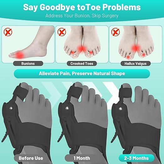 Bunion Corrector for Women and Men Big Toe,Upgraded Press-Button Bunions Correction,Toe Straightener with Bunion Relief,Suitable for Left and Right Feet,Large,Black 1Pack