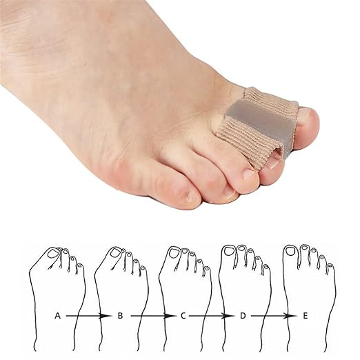 Toe Separator Sleeves, 2 Pairs Soft Breathable Big Toe Corrector with Gel Toe Spacer Cushion, Hammer Toe Overlapping Toes Straightener Sleeves for Big Toe Alignment Bunion Foot Pain Relief (S)