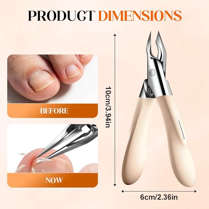 Nailpro Guard, 2025 New Designed for Ingrown and Thick Nails, Portable Ultra Sharp Stainless Steel Nail Clippers, Ultra-Thin, Easy Grip and Squeeze, Featuring Permanently Sharp Steel (Pink)
