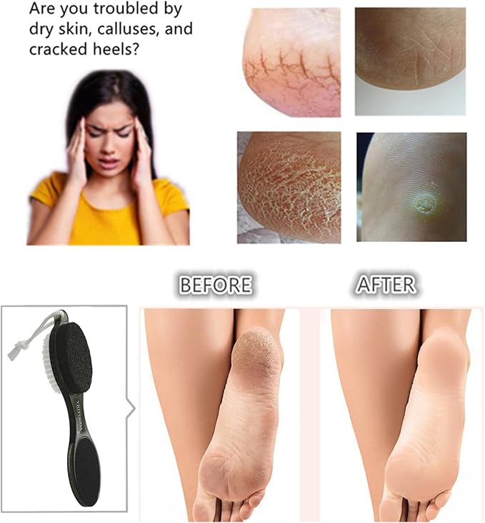 Foot File Callus Remover 4-in-1, Feet Scraper Pedicure Tools with Pumice Stone, Foot Scrubber Brush, Foot Rasp and Sand Paper, Double Sided Multi Purpose for Home Foot Care, Clear Black