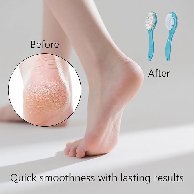 Foot Callus Remover, Double-Sided Pumice Stone Brush for Feet (Blue, 2 Pack)