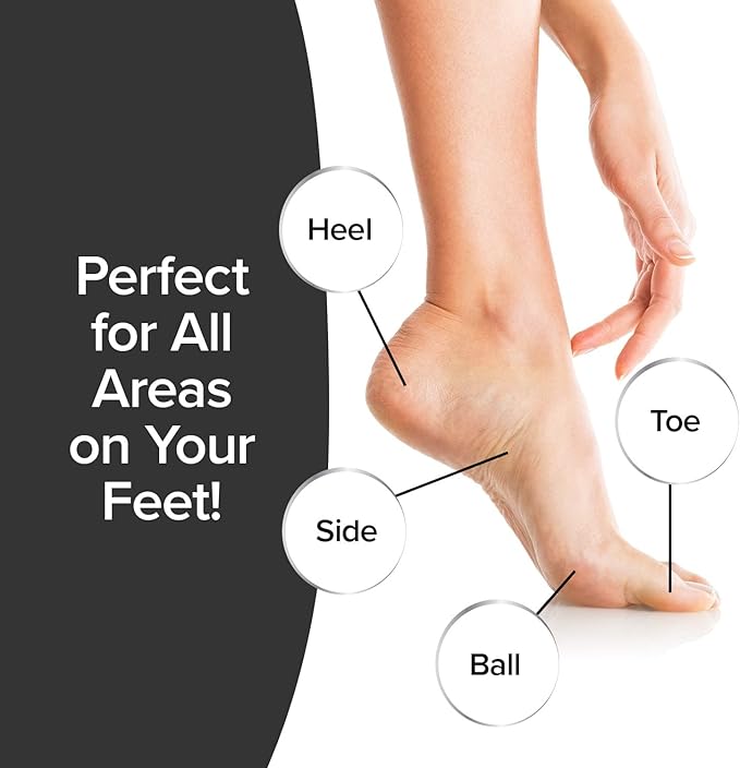 PedEgg Classic Callus Remover, As Seen On TV, New Look, Safely & Painlessly Remove Tough Calluses Dry Skin to Reveal Smooth Soft Feet, 135 Precision Micro-Blades, Traps Shavings