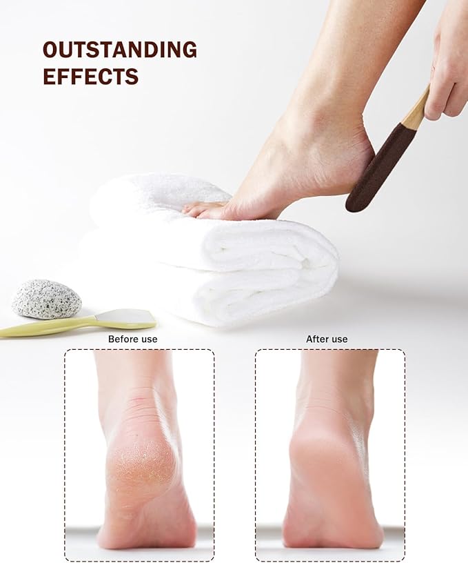 BEZOX Foot Pumice Stone Pedicure File(1 PCS) - Ergonomic Wooden Handle Foot File Callus Remover for Smoother Feet and Hands - Foot Scrubber, Heel Sander and Dead Skin Scraper - Brown