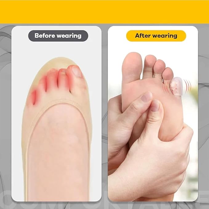 Silicone Anti-Friction Toe Protector, Gel Toe Protectors Breathable Toe Covers, Silicone Little Toe Sleeves Gel Toe Protectors Women with Airflow Orifice Breathable Toe Separators (50pcs)