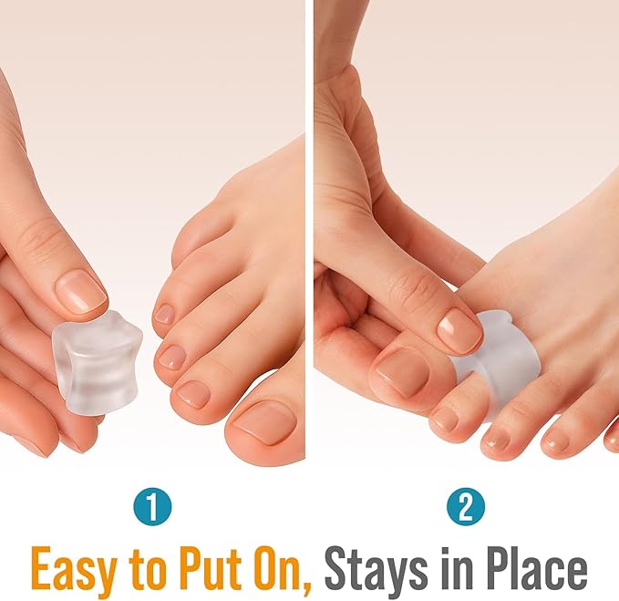 5 STARS UNITED Big Toe Spacers for Men & Women – 4 Gel Separators for Overlapping & Curled Toes, Bunions, Alignment - Diabetic Foot Care, Silicone Spreader, Corrector & Straightener, Clear
