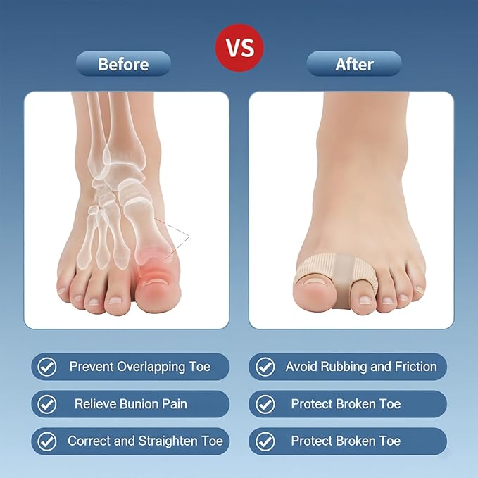 10 pcs silicone toe separators for women, big toe bunion corrector, bunion toe separators for Women and Men, Relieve Foot Pain, Overlapping Toes