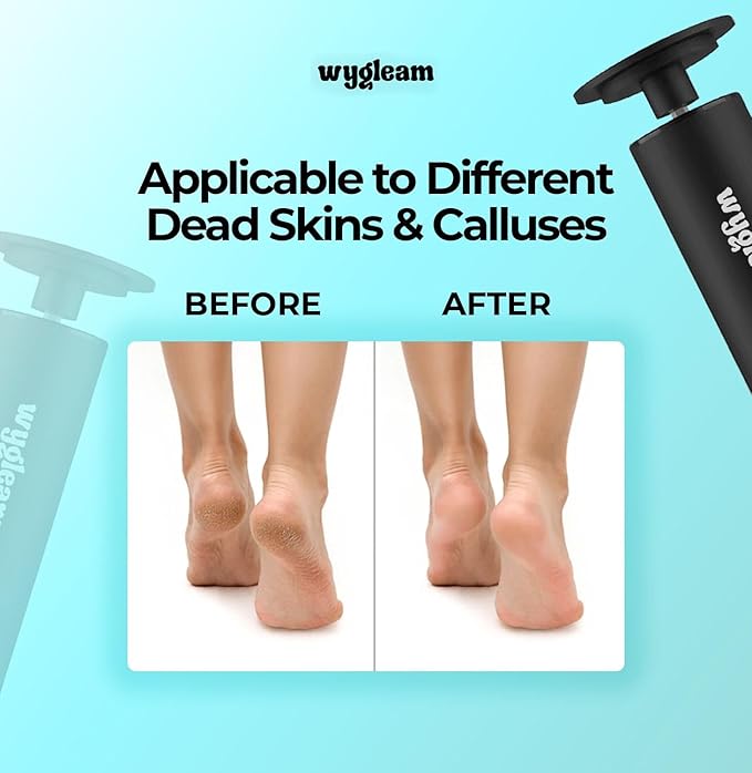 2-in-1 Electric Callus Remover and Nail File Drill Kit for Flawless Feet & Nails - 3 Speeds, Rechargeable, Professional at-Home Pedicure & Manicure Tool