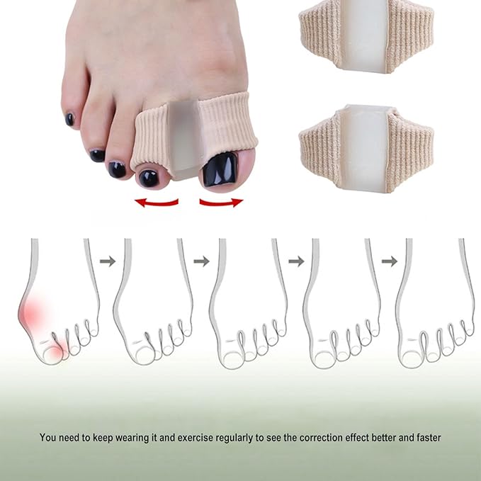 6-pack Toe Separators for Women & Men - Corrector Pads for Hallux Valgus to Relieve Big Toe Discomfort and Foot Pain During Pedicure