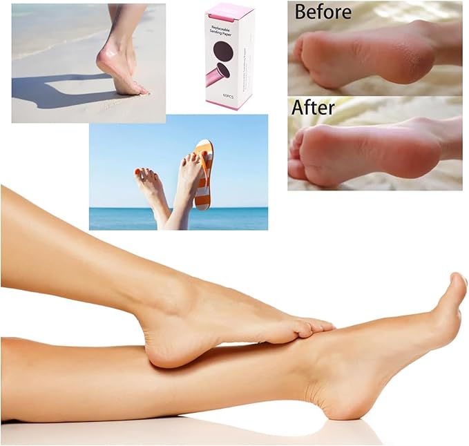 Electric Feet Callus Remover Professional Powerful Foot File Pedicure Grinder Sanders with 60PCS Replacement Sandpaper Discs Heel Scraper for Dead Dry Crack Skin Calluses Speed Adjustable Silver