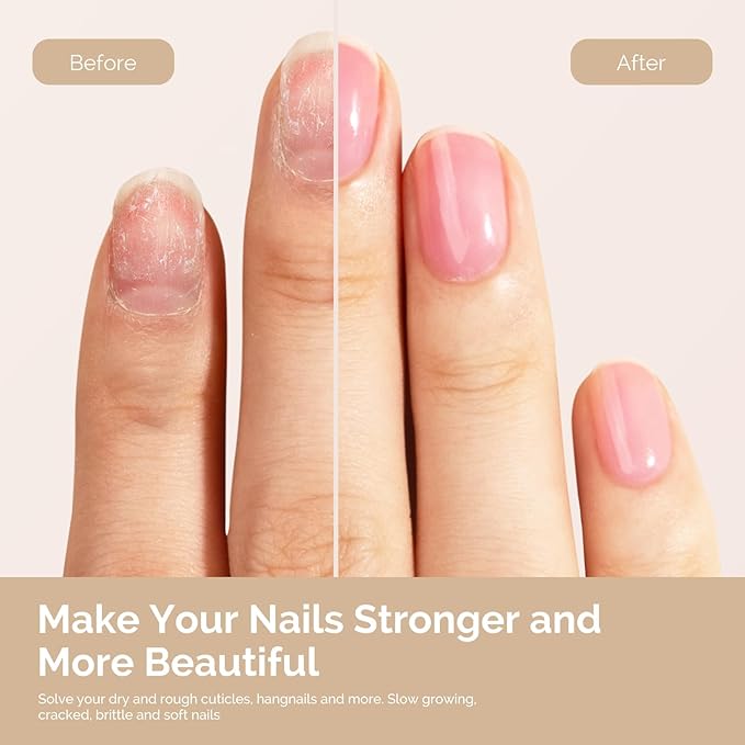 MelodySusie 15ML Cuticle Oil,Nail Strengthener with Jojoba& Vitamin E,Nail Growth that Repairs Cuticles & Promotes,Moisturizes & Conditions Dry Skin,Lavender