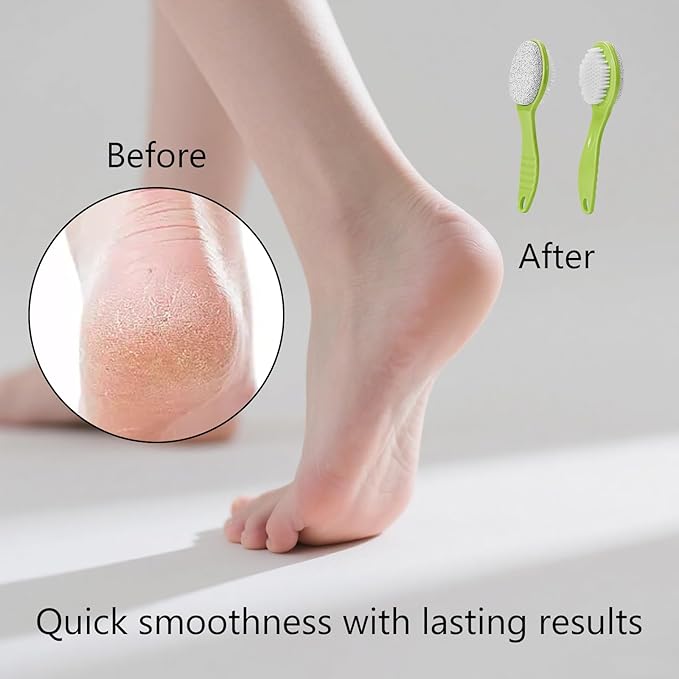Foot Callus Remover, Double-Sided Pumice Stone Brush for Feet, 2 Pack Foot File Scrubber for Home Feet Care, Multi Purpose Pedicure Tools with Handle for Dead Skin Remover in Shower, Green