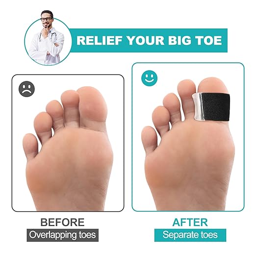 8 Pack Big Toe Spacers Toe Separators for Women and Men, Gel Bunion Corrector with Elastic Band for Bunion Overlapping Correct Toes