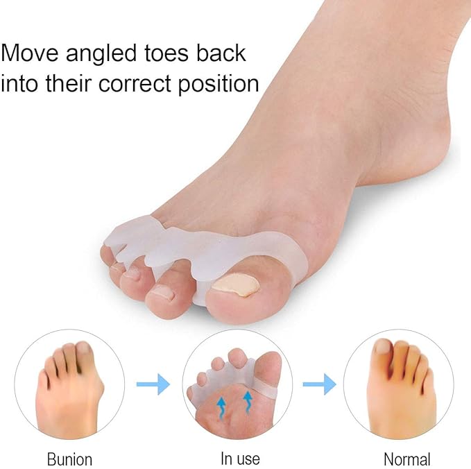 Silicone Toe Separators for Women & Men, Soft Toe Stretchers Separators Straighteners, to Correct Toes Bunion Relief Hammer Toe Plantar Fasciitis Overlapping Toes Toe Spacers Toe Foot Pain Relief