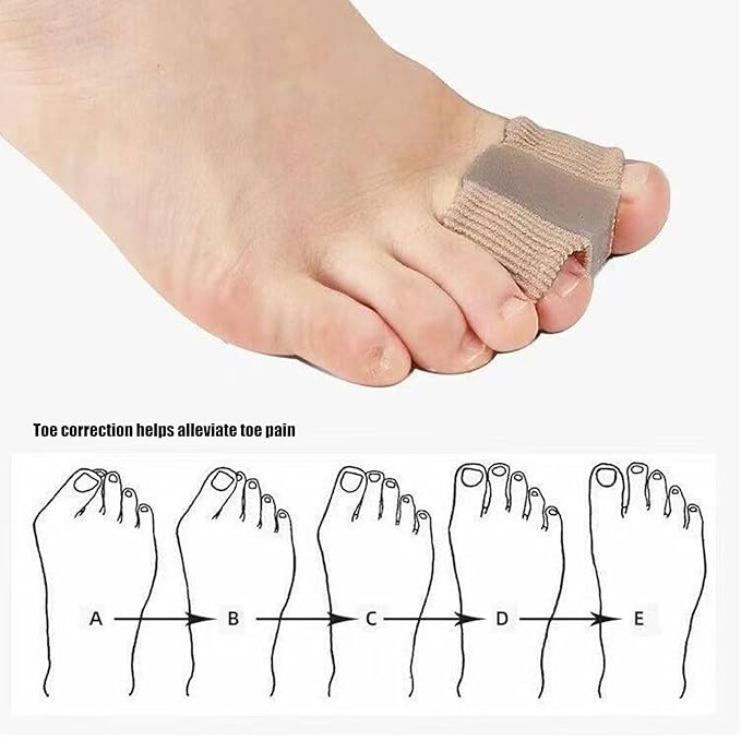 6-pack Toe Separators for Women & Men - Corrector Pads for Hallux Valgus to Relieve Big Toe Discomfort and Foot Pain During Pedicure