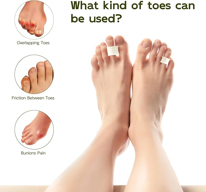 Bukihome Toe Separator for Overlapping Toes - Foams Toe Spacers for Bunions - Toe Corrector for Hammer Toes, Realign Crooked Toes - Preventing Rubbing Relieve Pressure - 2 Size, White