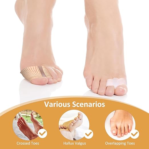 8 Pack Toe Separators Bunion Corrector with 2 Loops Overlapping Hammer Toe Separator Women Men Gel Toe Straightener Fabric Lining Splint for Feet Preventing Rubbing Relieve Foot Pressure