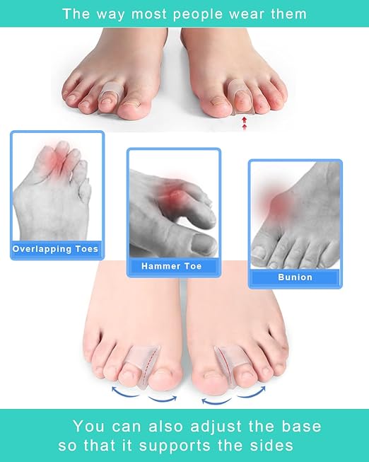 12 Packs Hammer Toe Straighteners Corrector for Women Men Curled, Crooked, Claw, Hammertoe Correction, Gel Toe Splint for Straightening, Bunion Spacer Separators (3 Sizes, Clear)