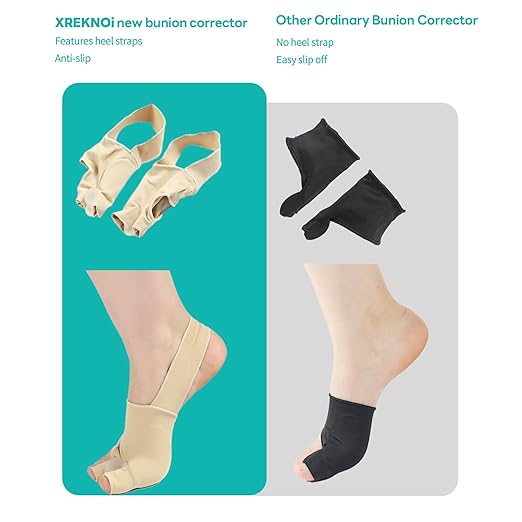 Bunion Corrector for Women and Men, Bunion Socks Sleeves Toe Corrector Comfortable & Breathable for Day/Night Support, Hallux Valgus Pain Relief Non-Slip Big Toe Straightener (Beige, Large(9-12))