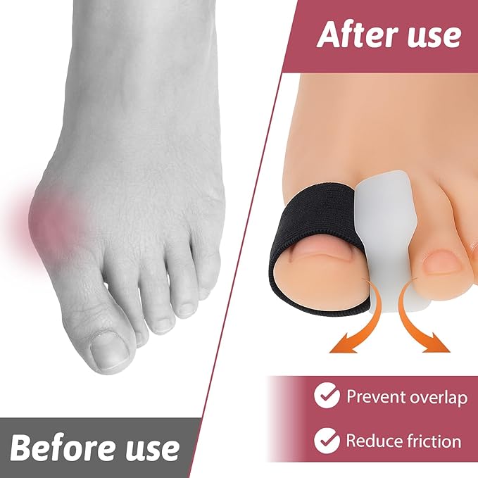 8 Pack Toe Separators for Women Toe Separators for Pedicure Overlapping Toes Separator for Men Correct Toes with Elastic Band