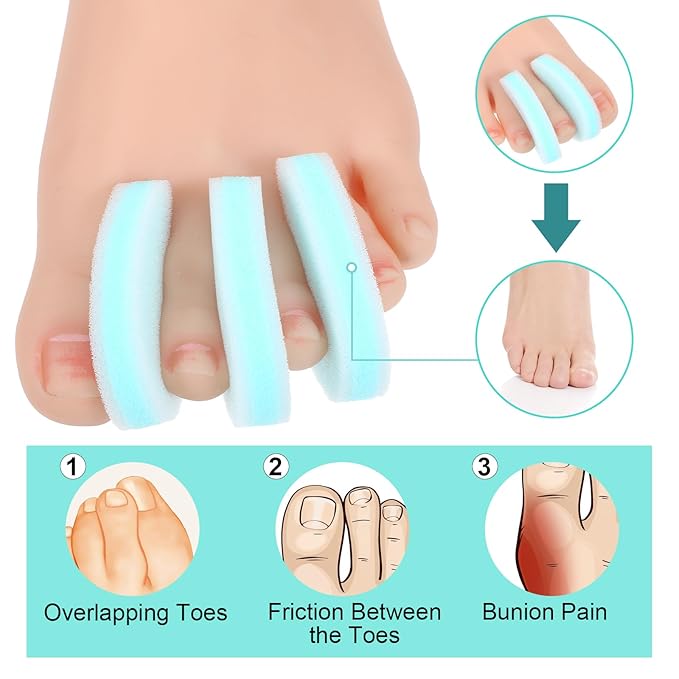20 Pack Foam Toe Separator, Breathable Toe Spacers for Women Men, Toe Spreader to Reduce Friction and Relieves Corns Pain, Relieve Pain Caused by Bunions