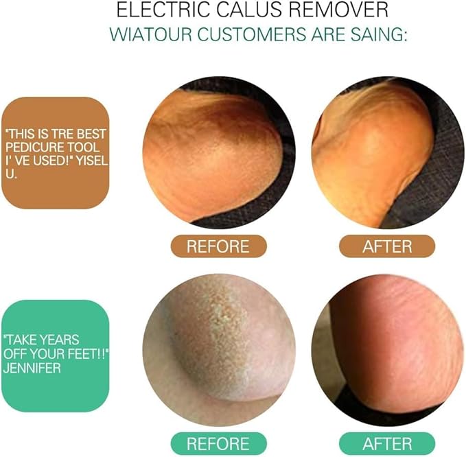 Electric Callus Remover, ELEVEN EVER Foot File Pedicure Tool(Speed Adjustable) with Recyclable Glass Grinder and 20pcs Replacement Sandpaper Disk for Men Women Dead Dry Crack Skin Calluses Black