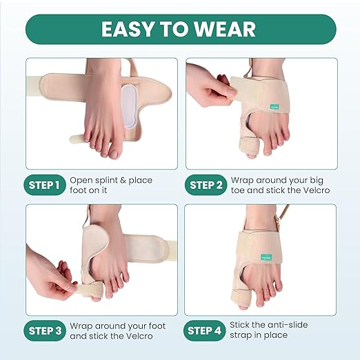 Welnove Bunion Corrector - Orthopedic Bunion Splint - Big Toe Separator Pain Relief - Bunion Correction Toe Straightener with Non-slip Strap, Day Night Support (Beige, 2 Count) - With 2 Gel Separators